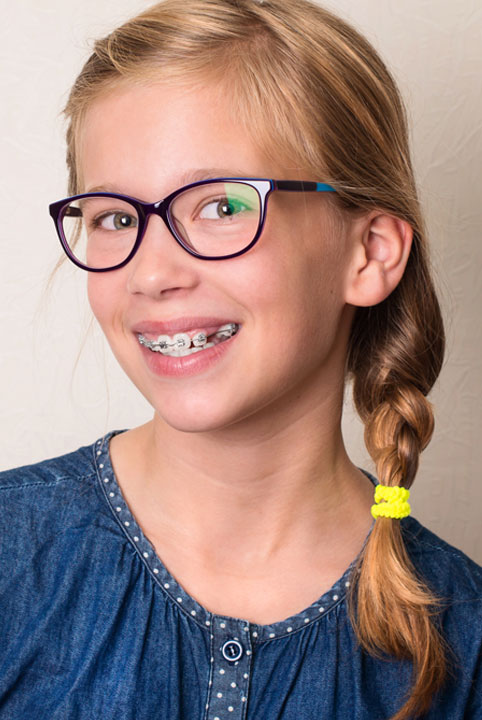 Discover the types of braces we use to treat our child patients.