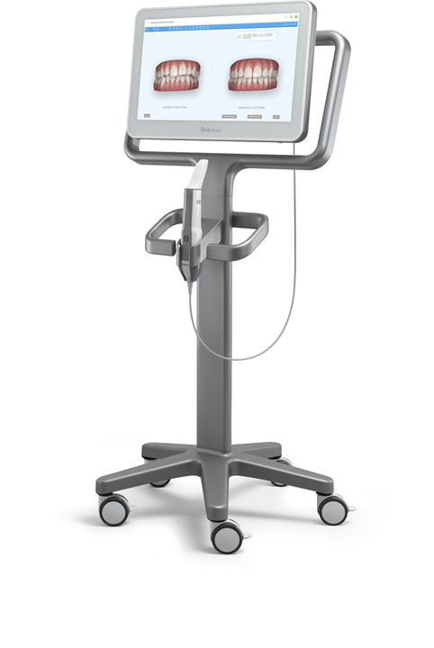 Say goodbye to messy bite moulds and hello to our cutting-edge digital scanner.