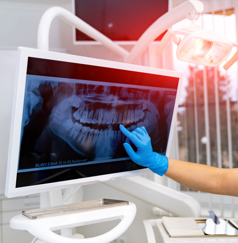 Why some adults may need jaw surgery