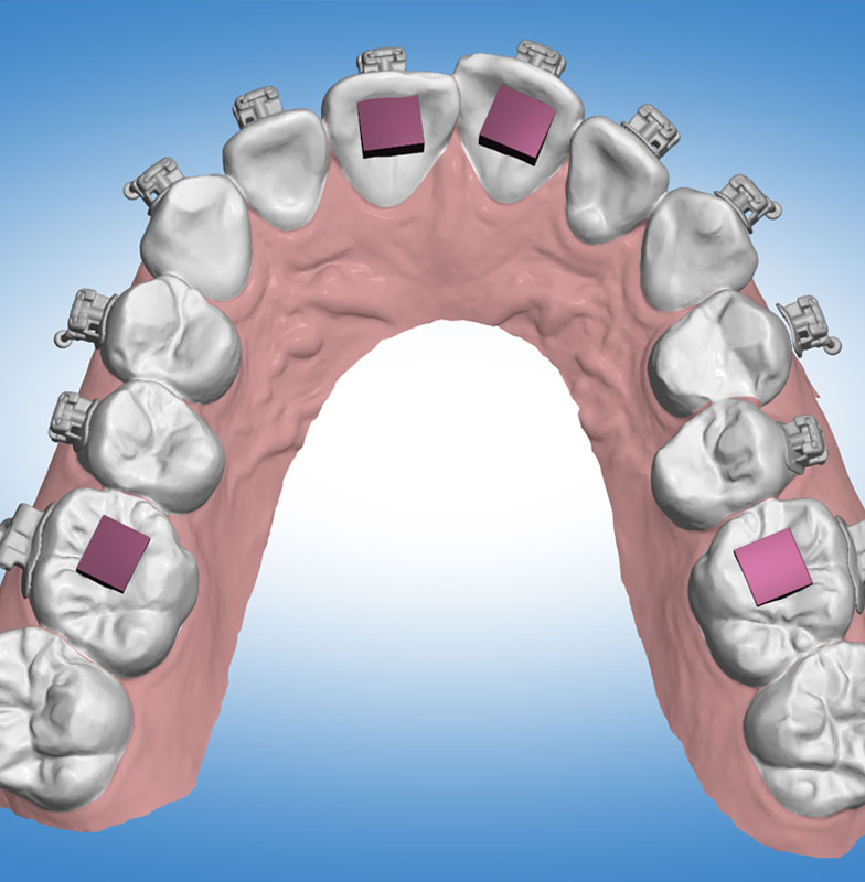 The power of digital planning