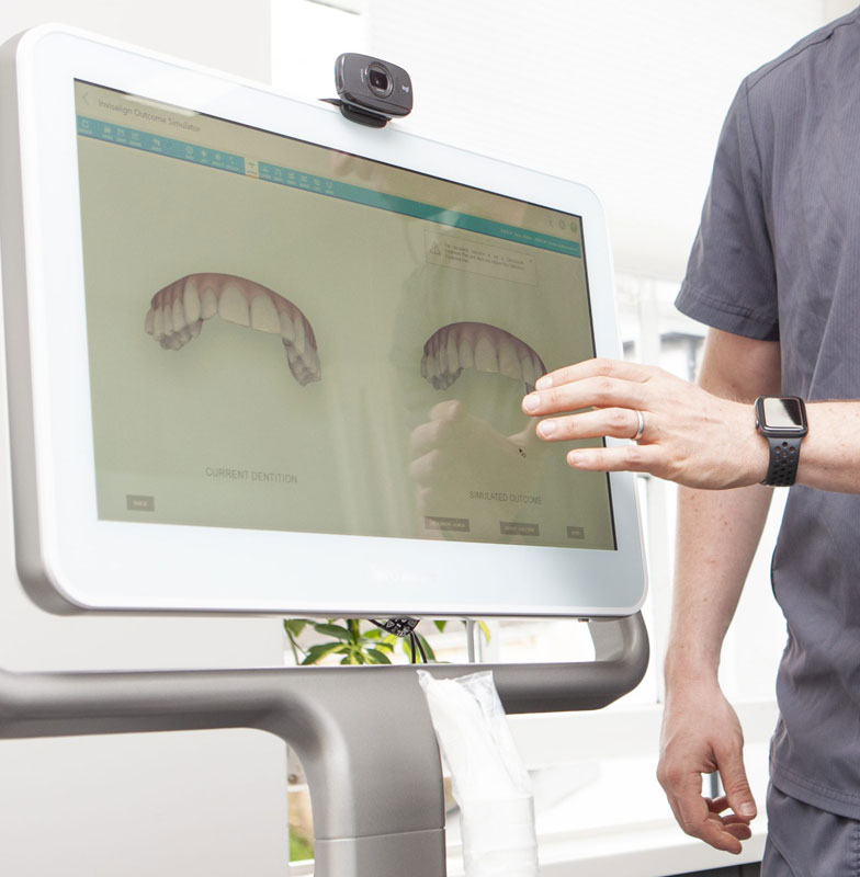 Why we use digital scanning