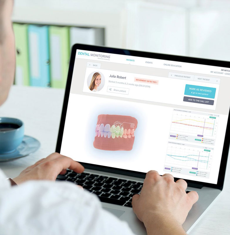 How Dental Monitoring works