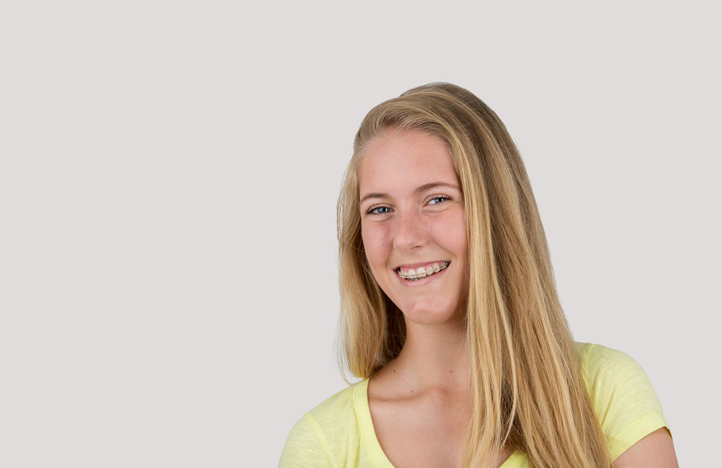 Life with braces/aligners 